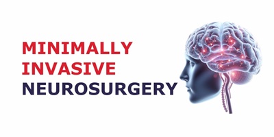 best-Minimally-Invasive-Neurosurgery-hospital-in-coimbatore